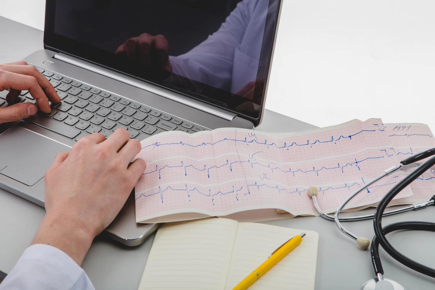 Electrocardiograma deportivo